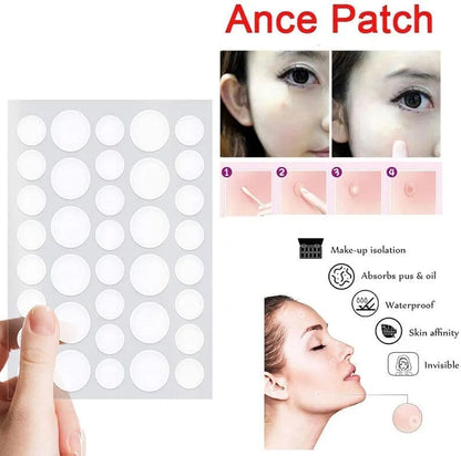 ✨ Invisible Acne Pimple Patches – Fast Spot Treatment & Oil Control (72 Patches Pack)