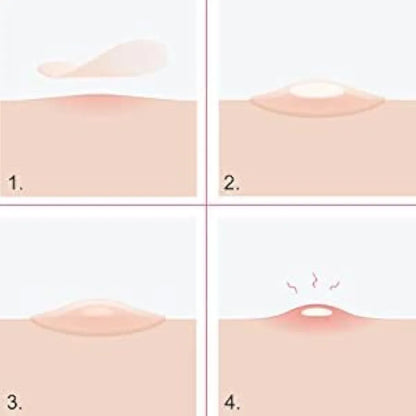 ✨ Invisible Acne Pimple Patches – Fast Spot Treatment & Oil Control (72 Patches Pack)