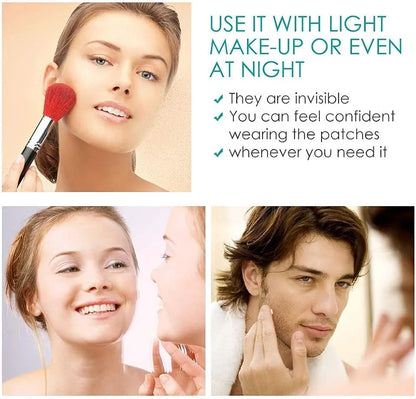 ✨ Invisible Acne Pimple Patches – Fast Spot Treatment & Oil Control (72 Patches Pack)
